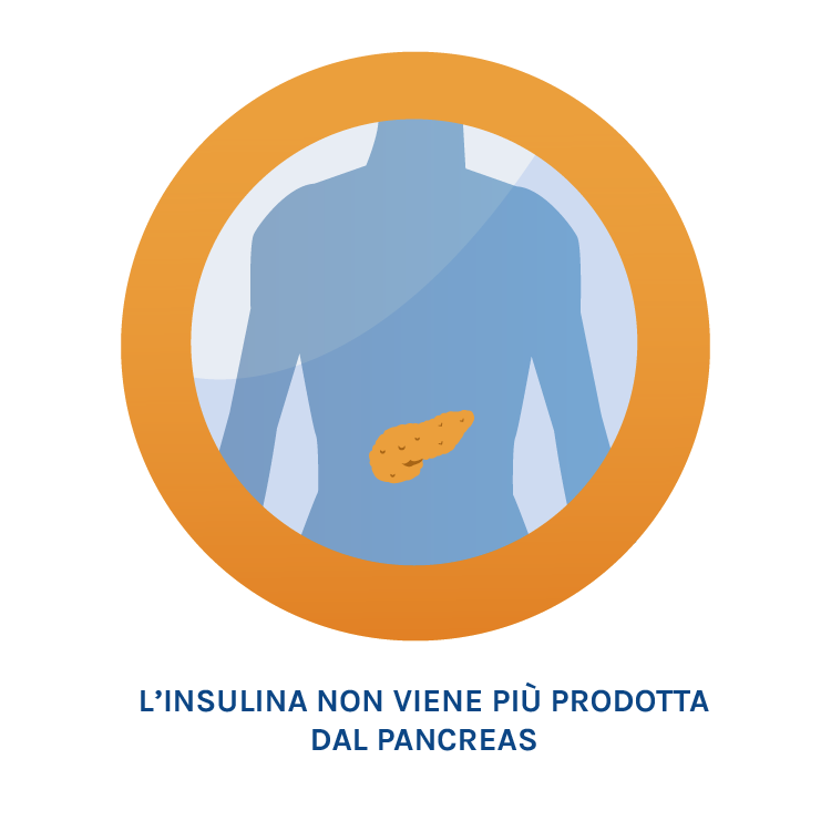 cos'è il diabete 4.png - 34,98 kB